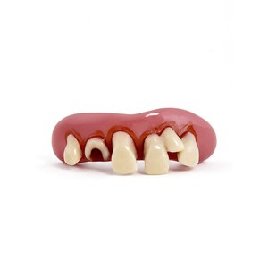 Denture avec dent pourrie