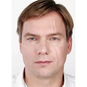 Collodium Narbenfluid 10ml