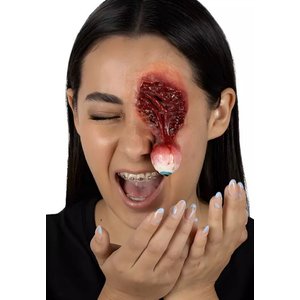 Herausgeplopptes Auge